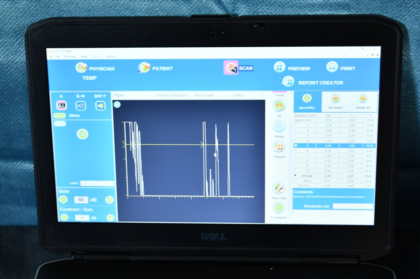Quantel Medical Aviso A and B scan Ultrasound complete