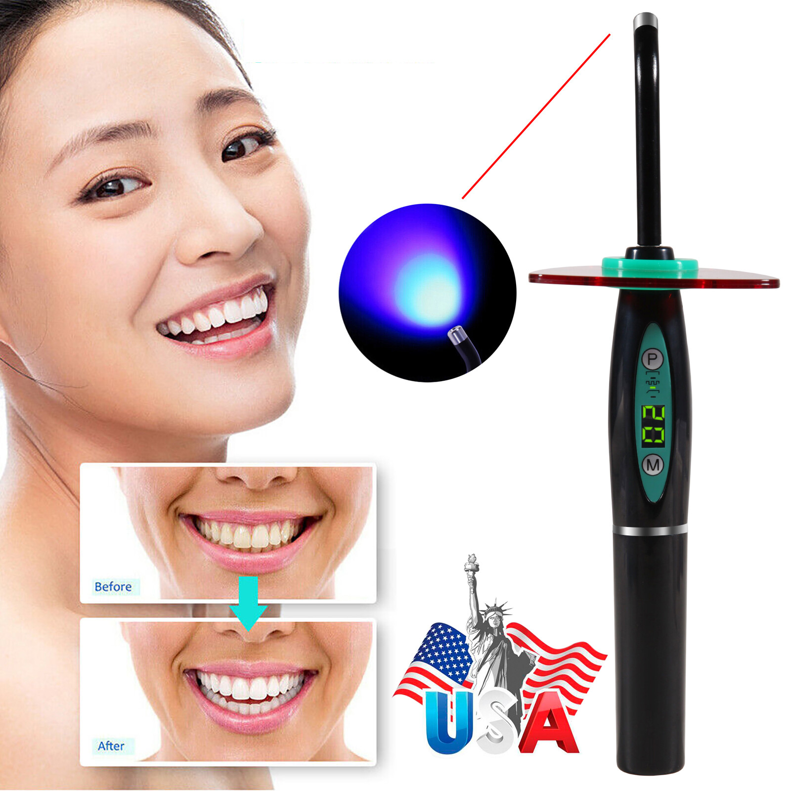 Wireless Cordless Dental Curing Light Lamp Teeth Whitening Woodpecker Style