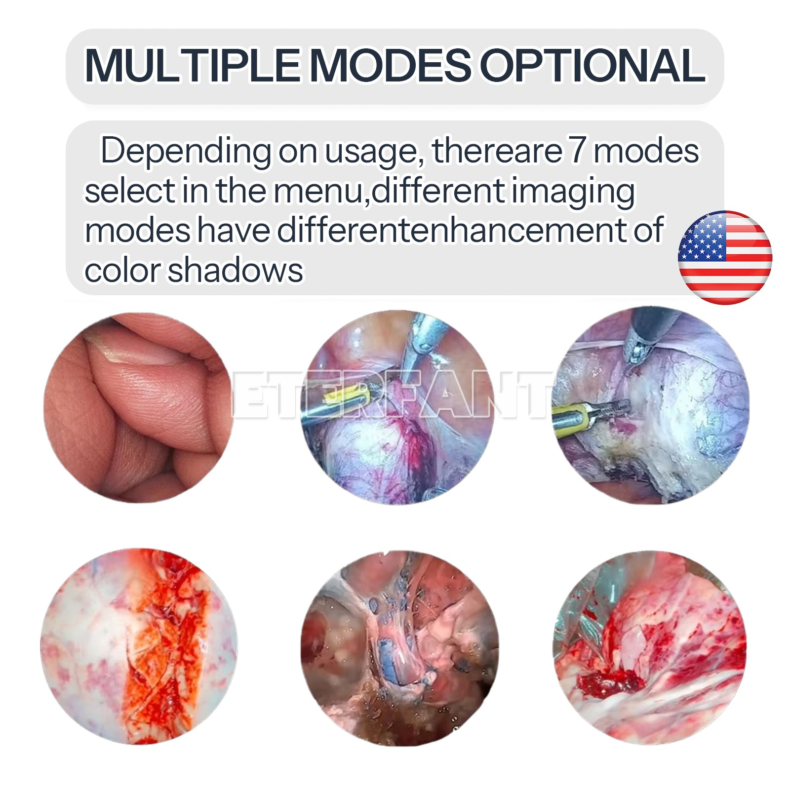 1080p Full HD ENT Endoscopy Laparoscopic Camera/100W Cold Led Light Source