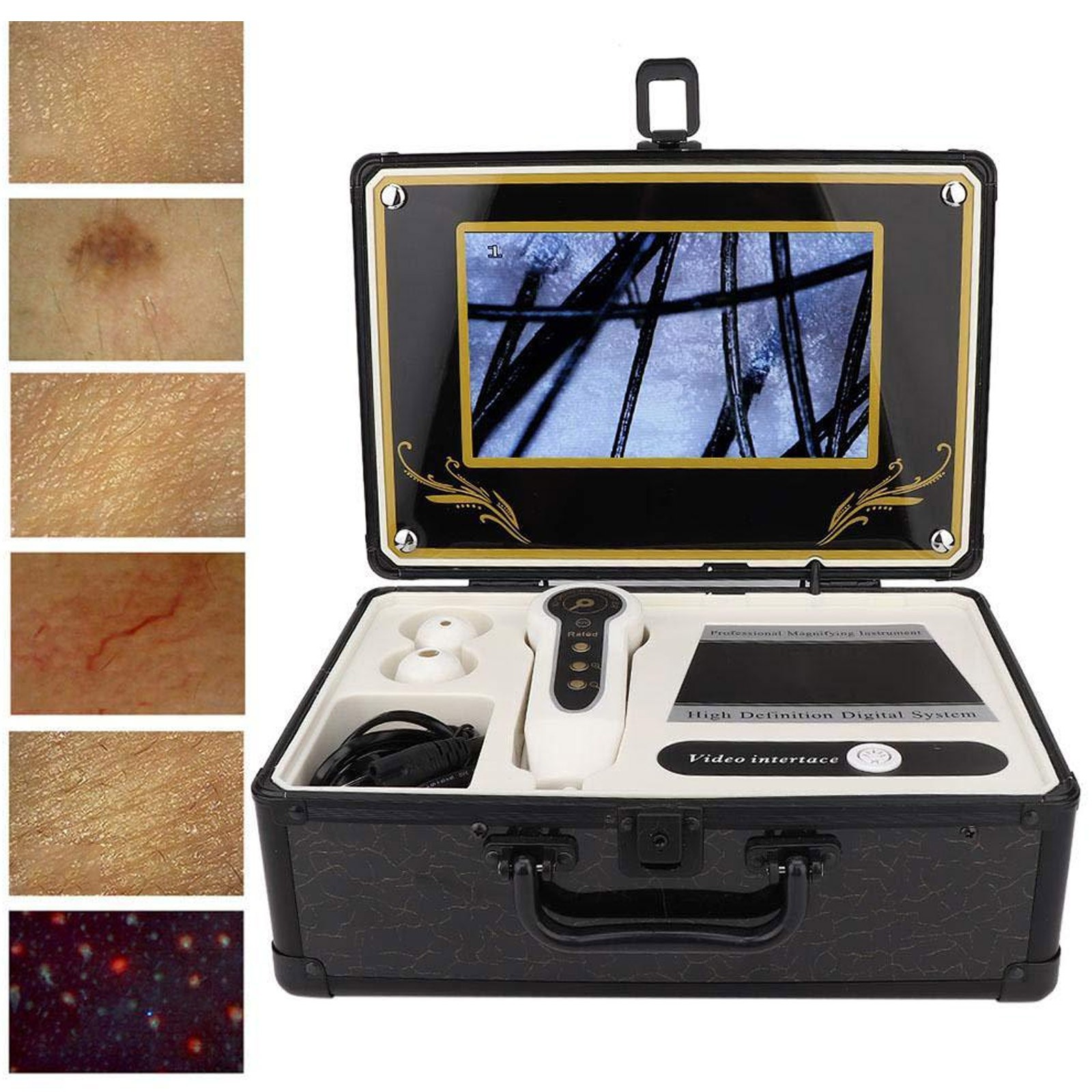 Professional 50X 200X Skin Hair Scalp Detector Analyzer Microscope Skin Care HPT