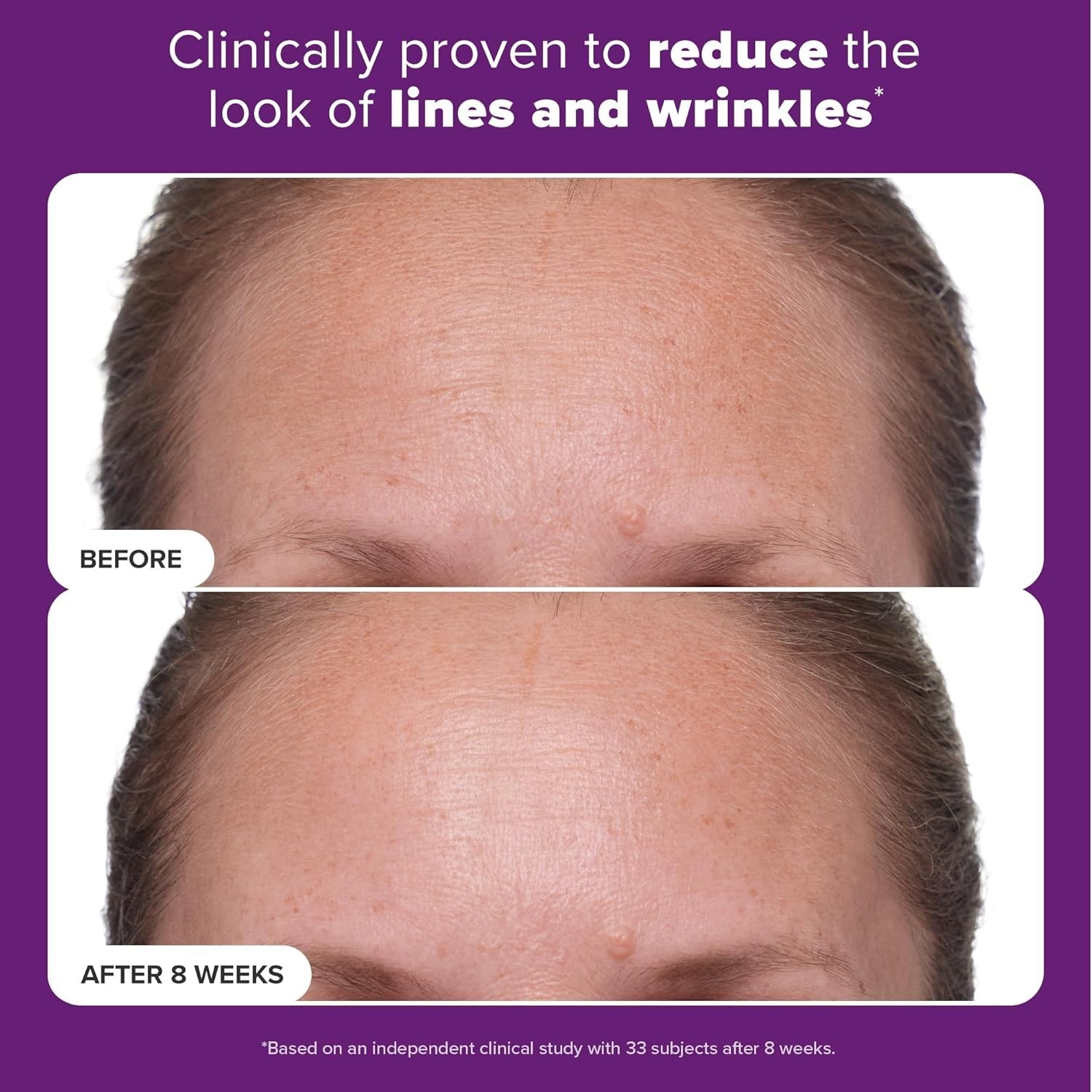 Paula's Choice CLINICAL 1% Retinol Face Treatment with Peptides, Vitamin C & Lic