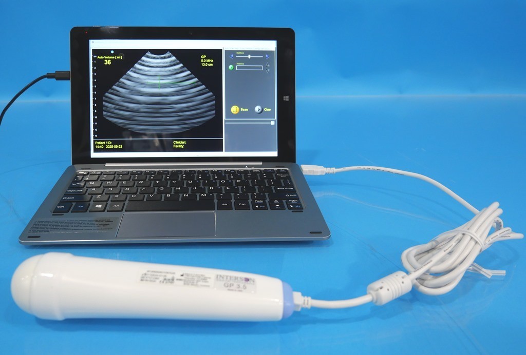 Interson ViewBladder 10 Tablet Bladder Scanner