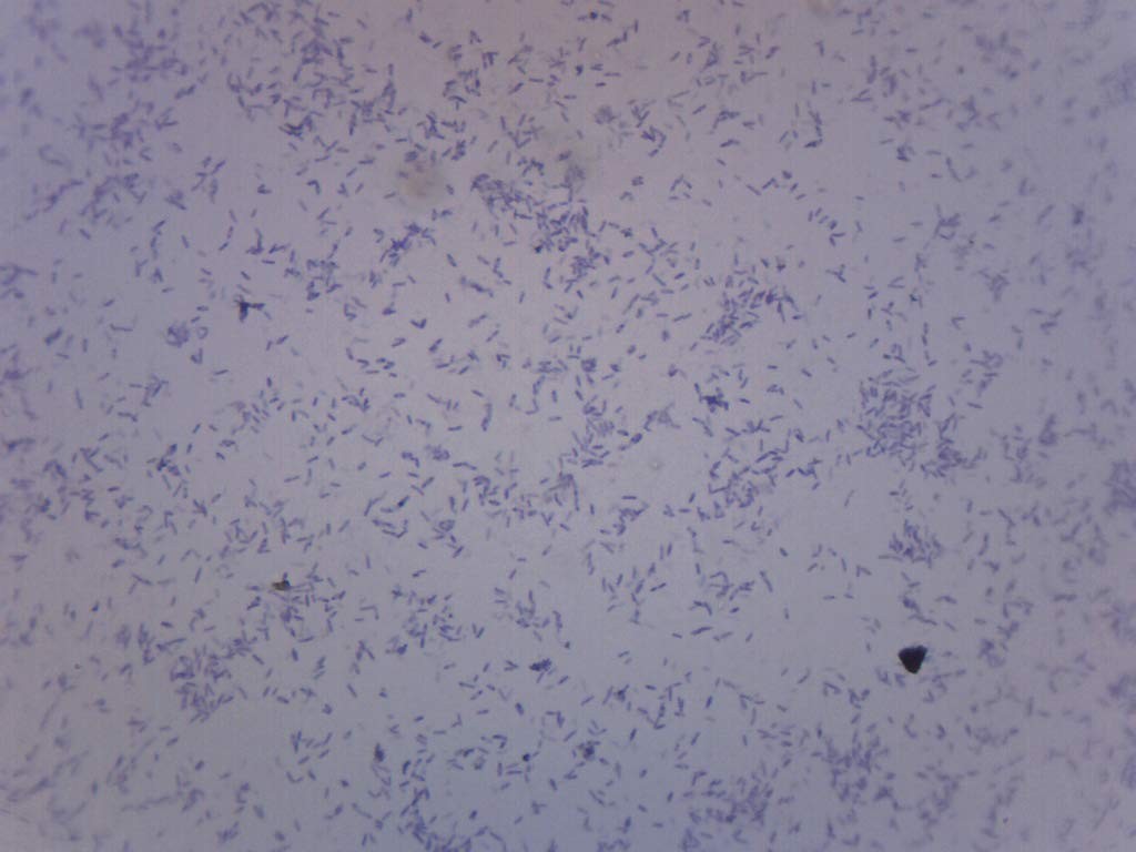 EISCO Clostridium Botulinum, Gram-Positive - Prepared Single Slide, Clear