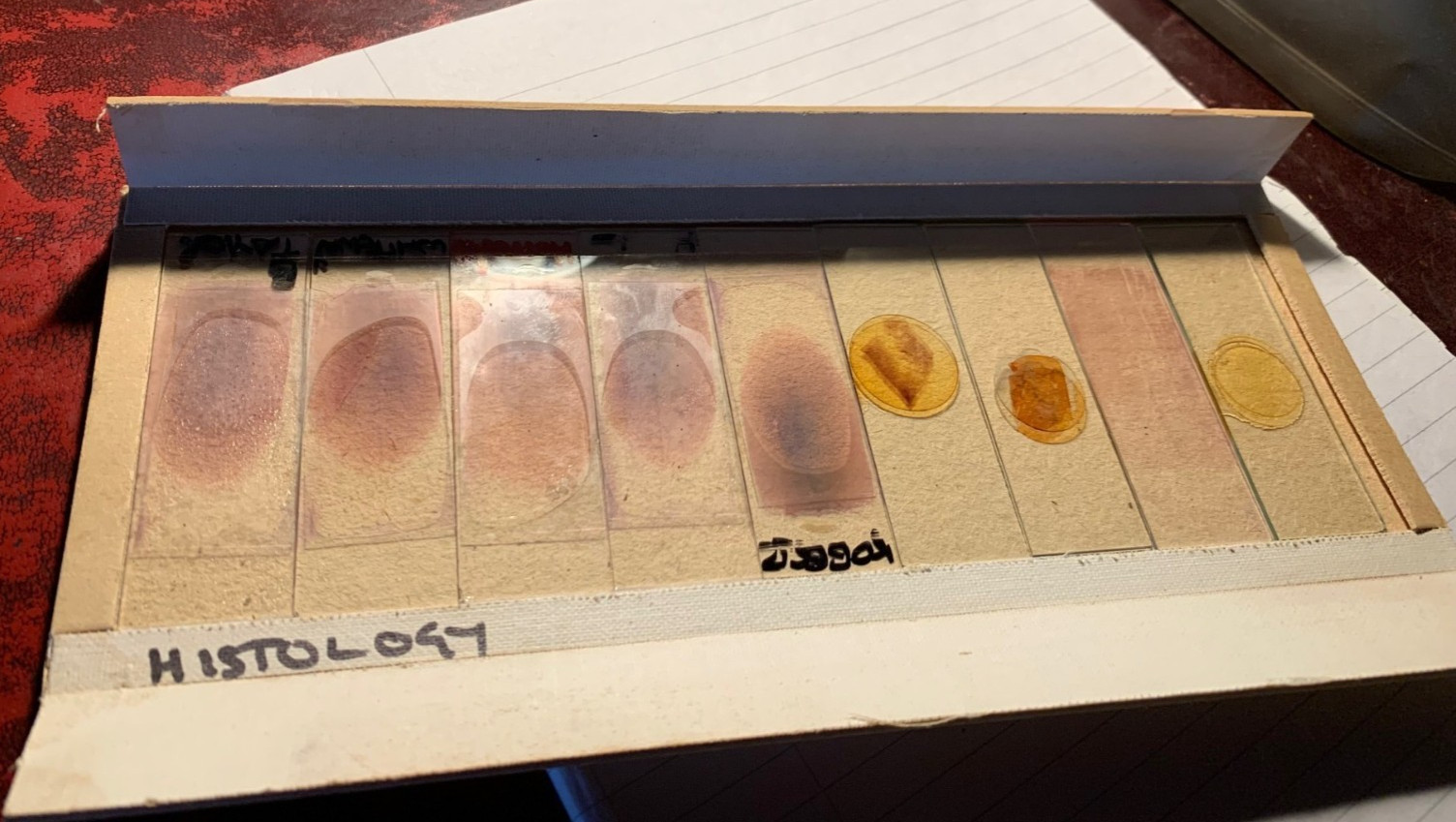 Set of 9 Prepared Histology Microscope Slides Like Dexter's Blood Film Trophies!
