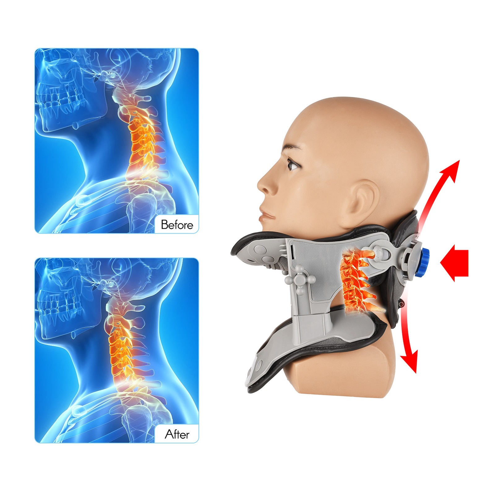 Neck Traction Device Stretcher Cervical Traction Device Adjustable Pain Relief