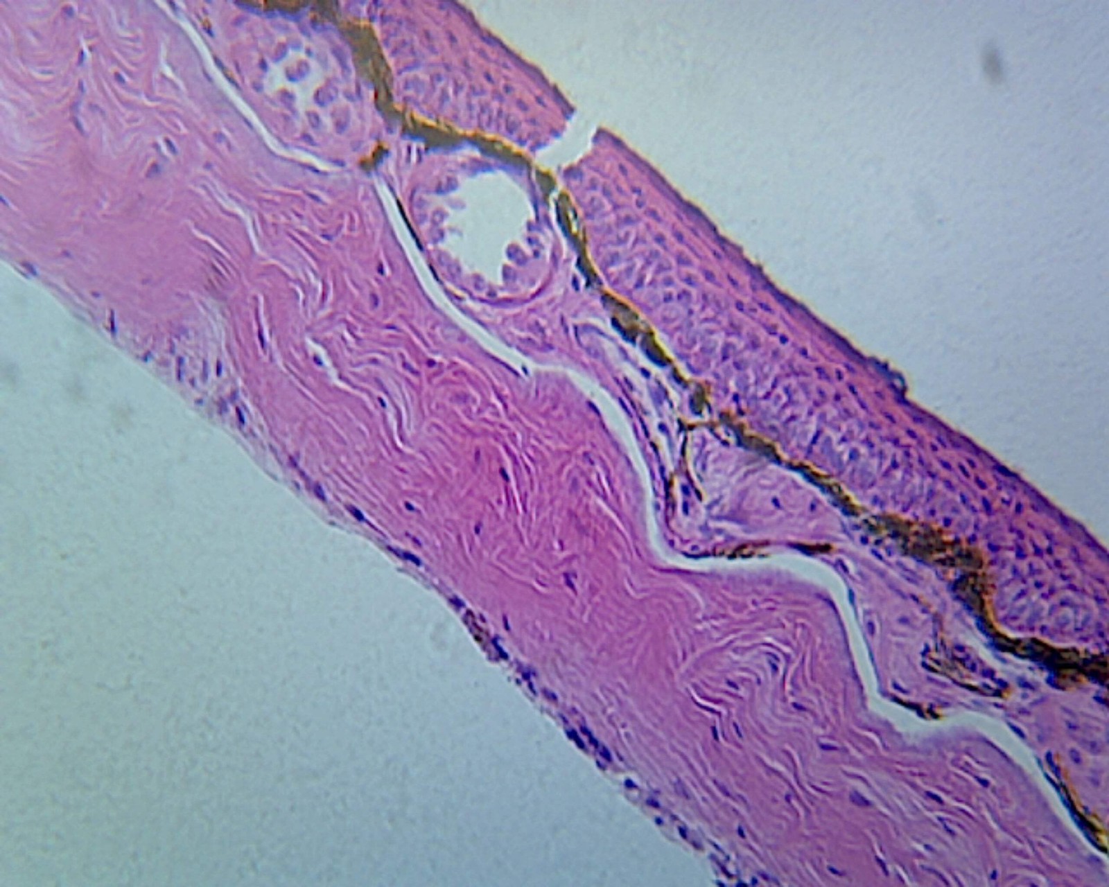 Frog Skin; Section