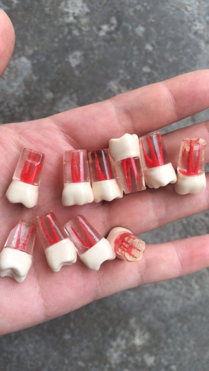 10x Dental clear Root Canal Teeth Study Practice Model Endodontic Pulp File