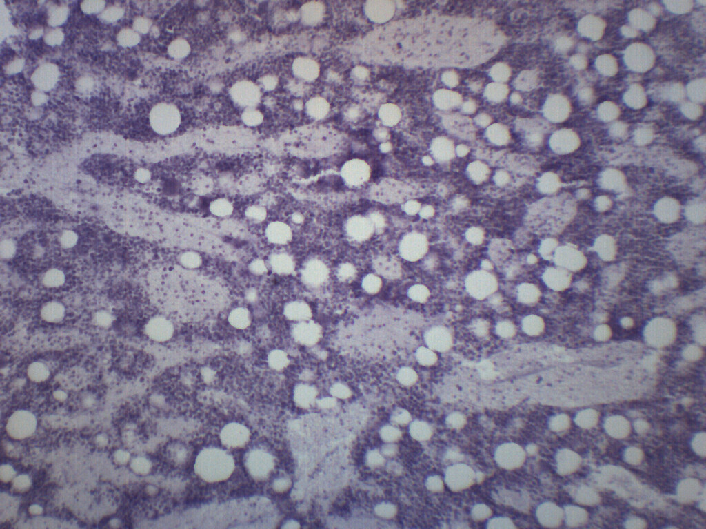 Red Bone Marrow Section - Prepared Microscope Slide - 75x25mm - Eisco Labs