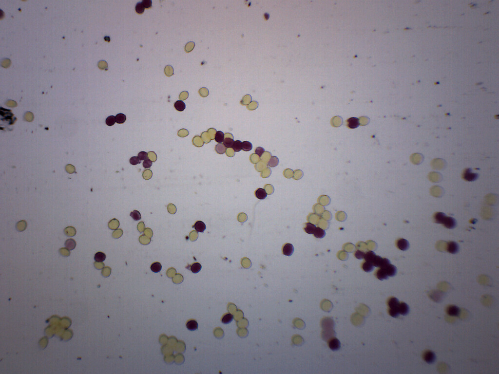 Ascaris Lumbricoides Egg - WM - Prepared Slide - 75x25mm - Eisco Labs