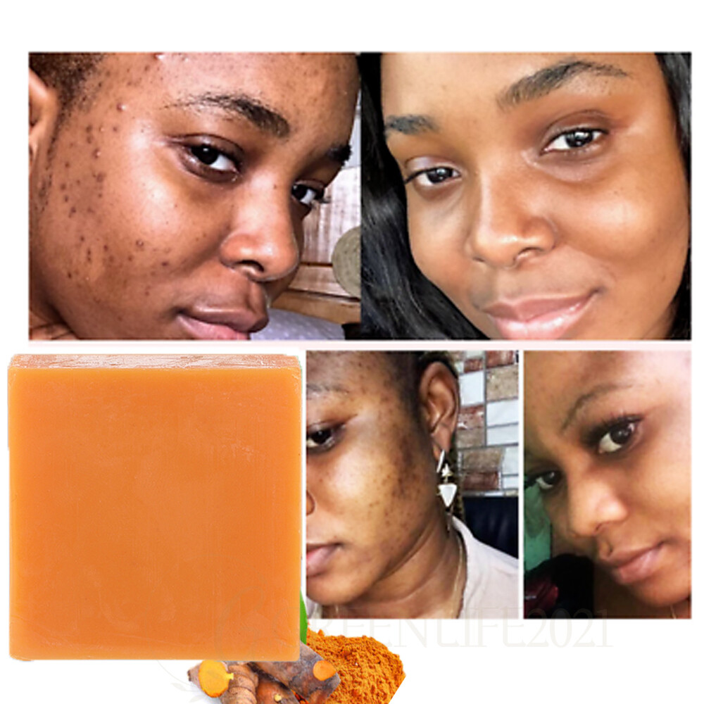 2Pc Turmeric Soap for Face&Body,Skin Brightening Anti-Acne Dark Spots Lightening