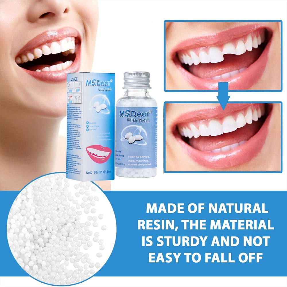 Tooth Repair Kit, Moldable False Teeth Beads for Filling Missing & Broken Tooth