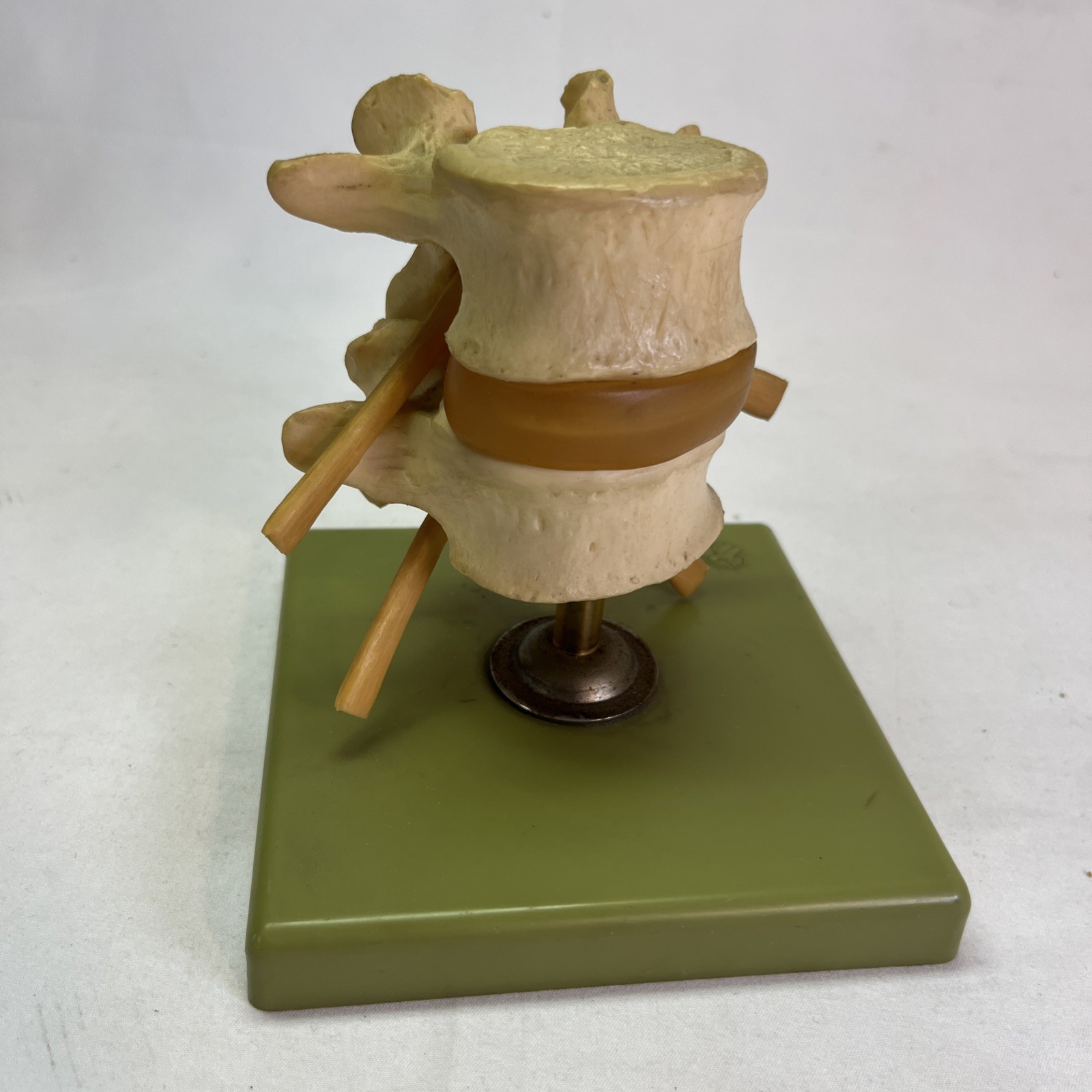 Somso QS68 Anatomical Model Vertebrae Vintage West Germany