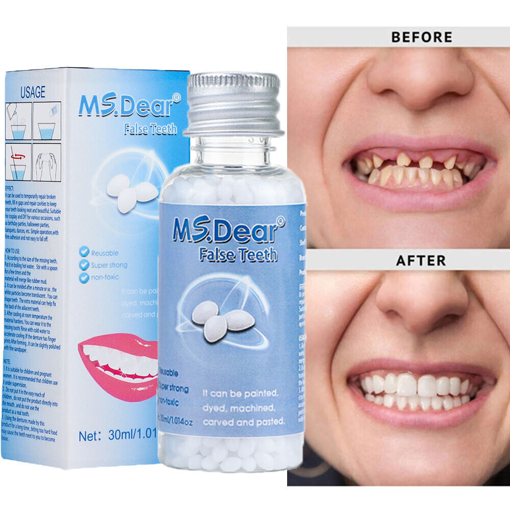 2× Tooth Repair Kit, Temporary Teeth Replacement Kit for Missing & Broken Teeth