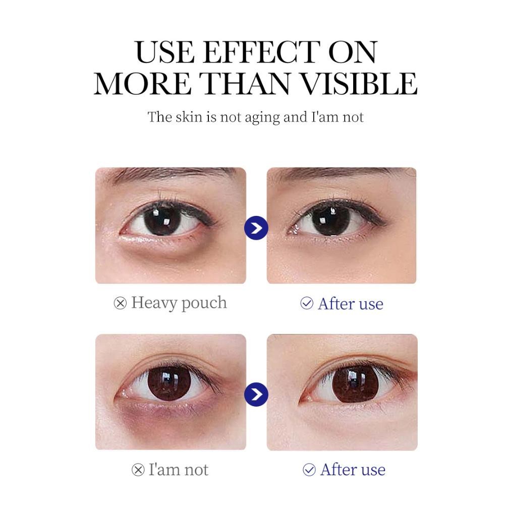 Collagen Anti wrinkle Eye Cream Remove Eye Bags & Dark Circles 1pcs J2K3 R6 P7Z1