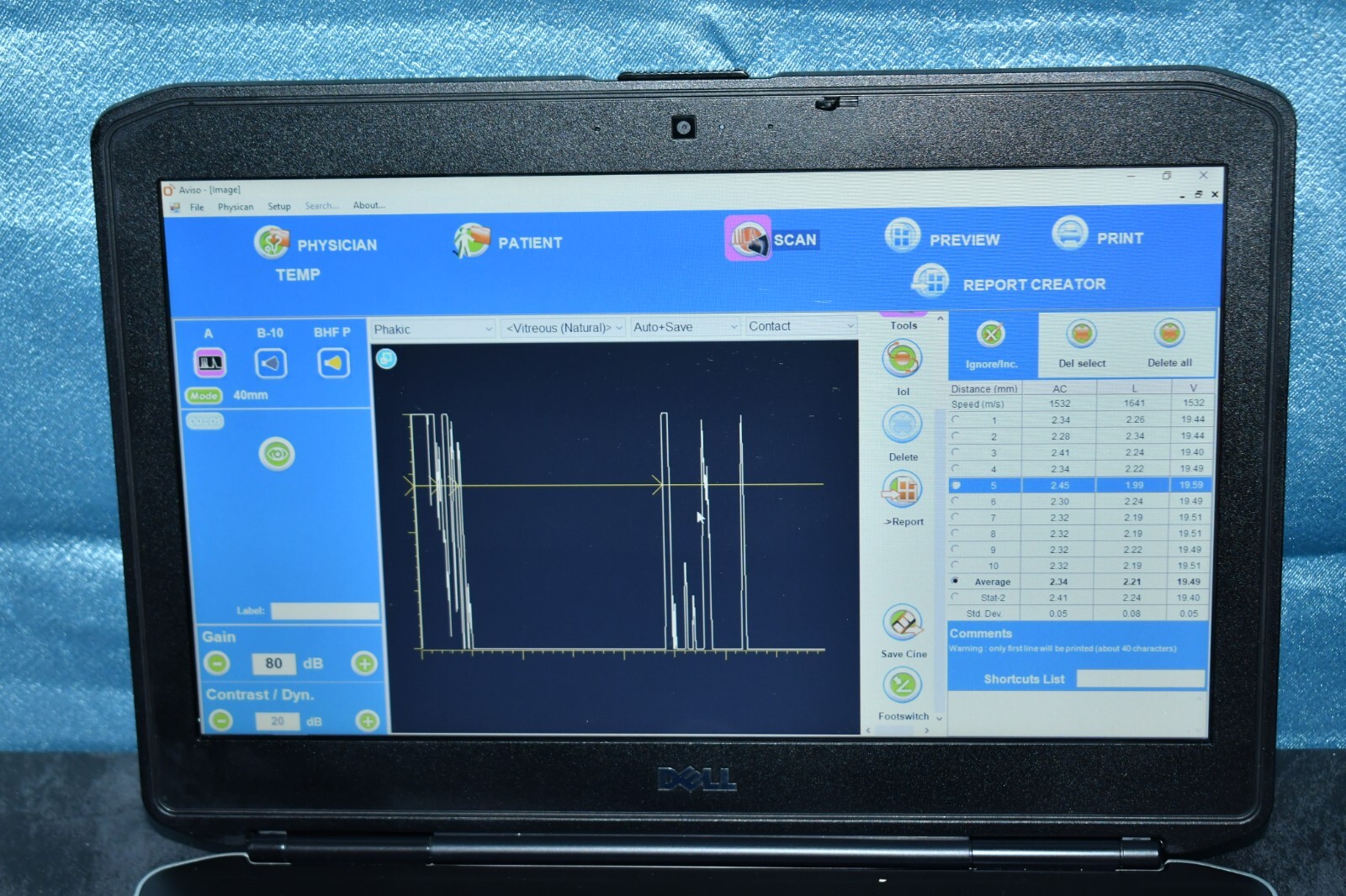 Quantel Medical Aviso A and B scan Ultrasound complete