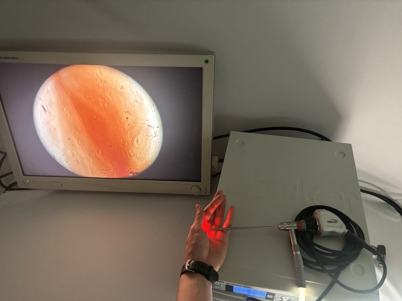 Stryker 1188HD Full System, Camera Console, L9000 Light Source, Camera & Scope