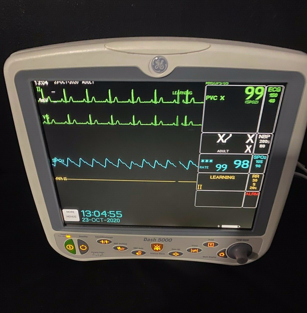 GE Dash 5000 Patient Monitor Sidestream EtCO2 Masimo SpO2 Patient Ready 6mo Wtty