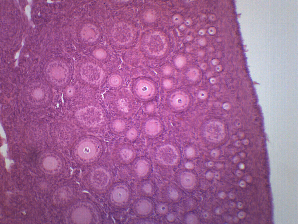 Immature Ovary - Prepared Slide - 75x25mm - Eisco Labs