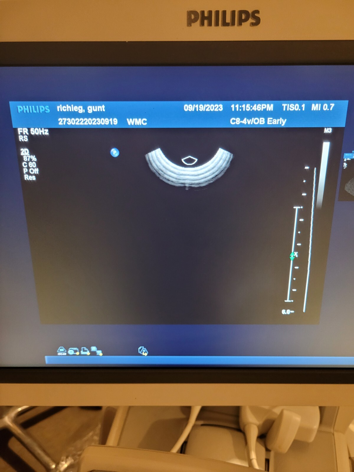 Philips C8-4V Endocavitary Transvaginal Probe 