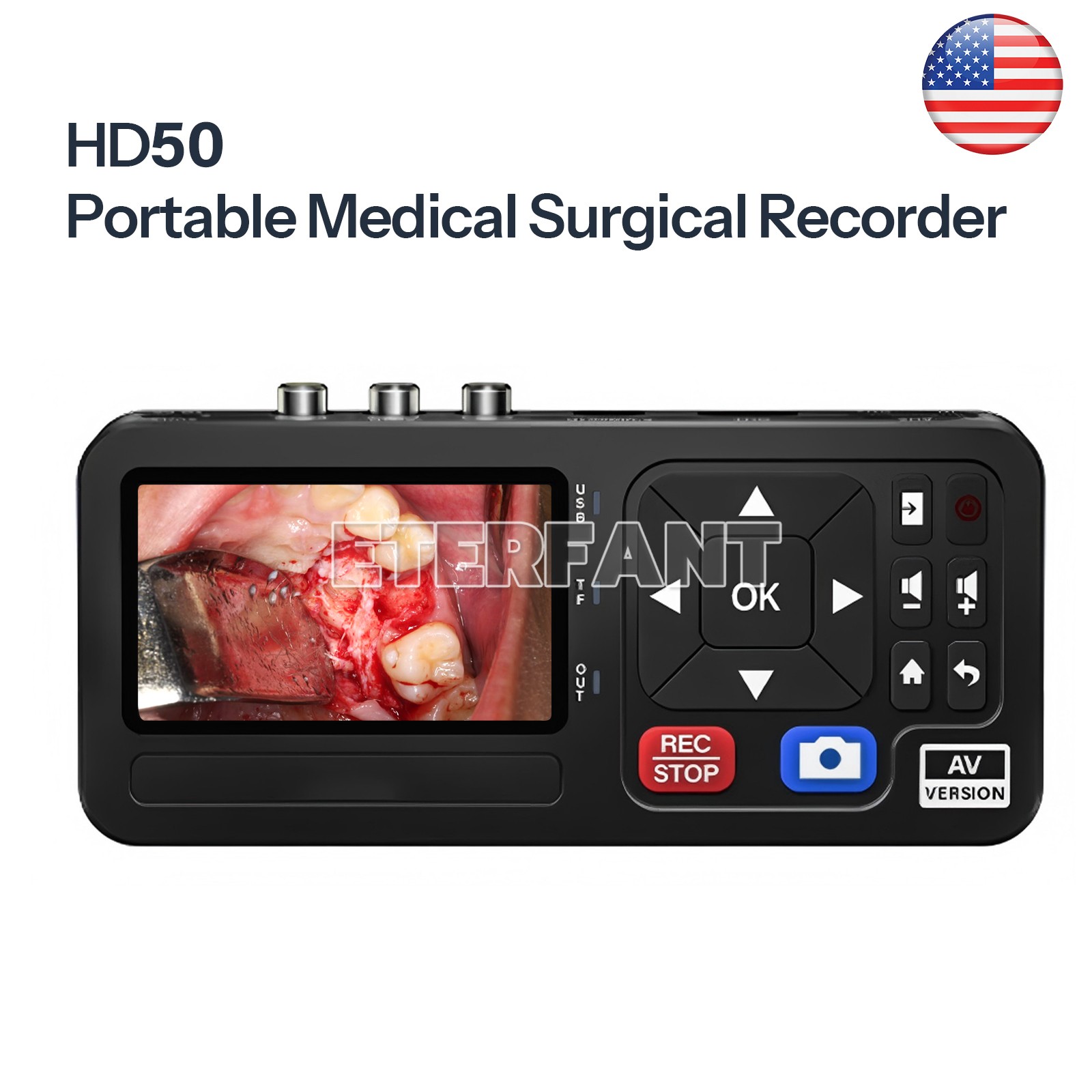 Medical Portable Surgical Recorder for Laparoscopy and Endoscopy Capture HD50 US