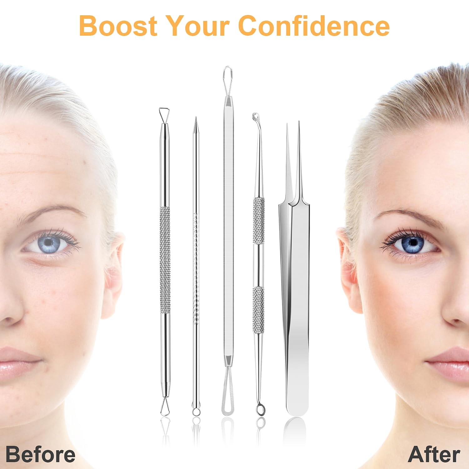 UUBAAR 9PCS Blackhead Remover Tools, Pimple Popper Tool Kit with 2 Silver