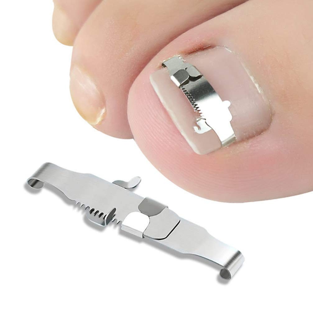 Ingrown Toenail Straightening Clip Stainless Steel Toenail Correction Clip Toe