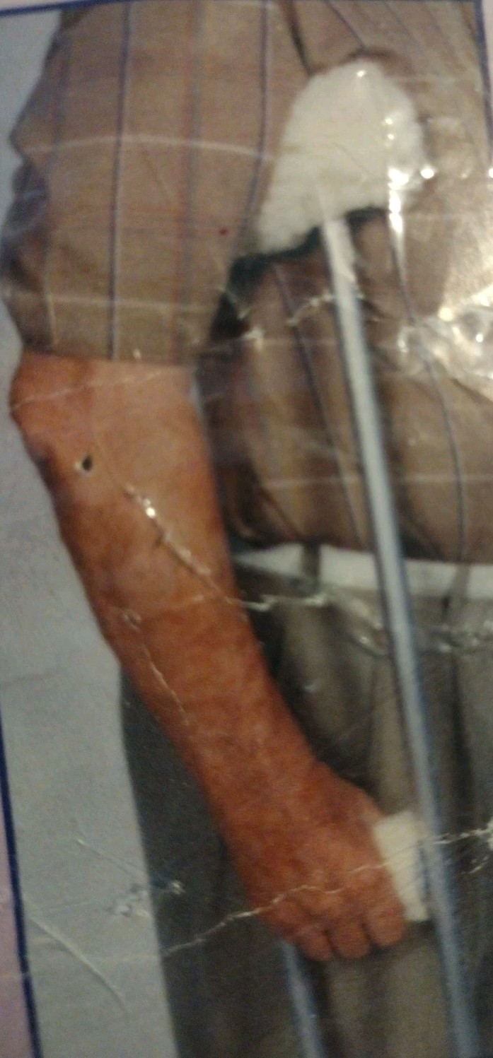 Crutch Covers