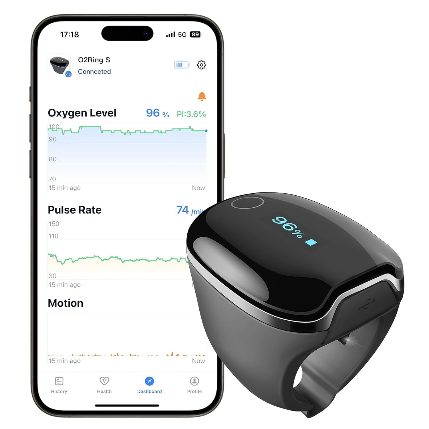 Wellue O2Ring-S Oxygen Monitor with Vibration Reminder, Bluetooth Pulse Oximeter