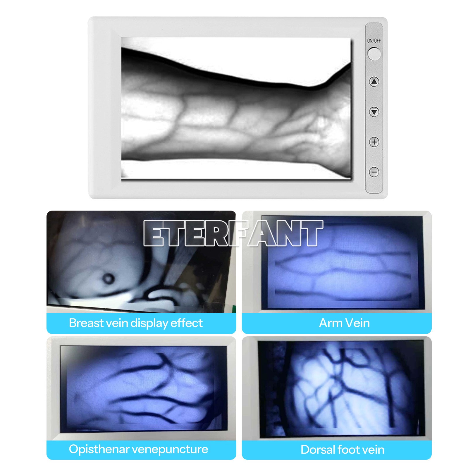 Portable Vein Finder Blood Vessel Searching Machine Near-infrared Vein Viewer