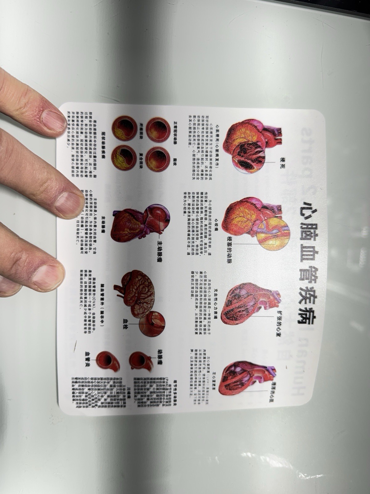 anatomical heart model