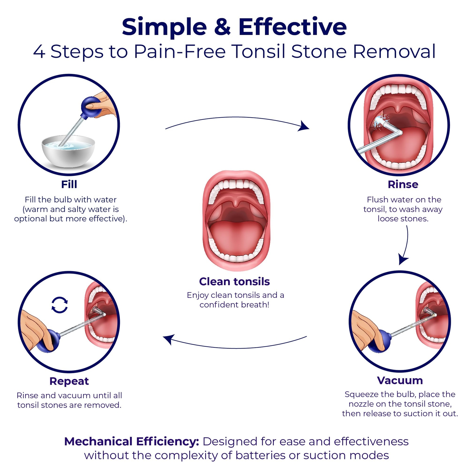Tonsil Stone Remover Vacuum - Easy Suction Tool for Tonsil Stone Extraction