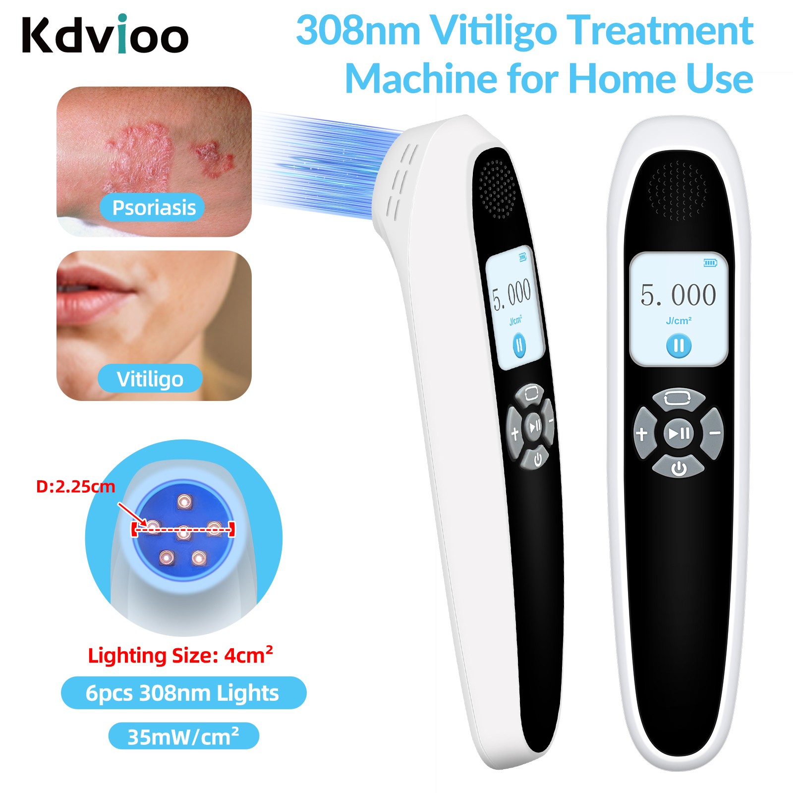 Medical 308nm UVB Light Therapy Device Promotes Skin Repair 6 Diodes 35mW/cm²