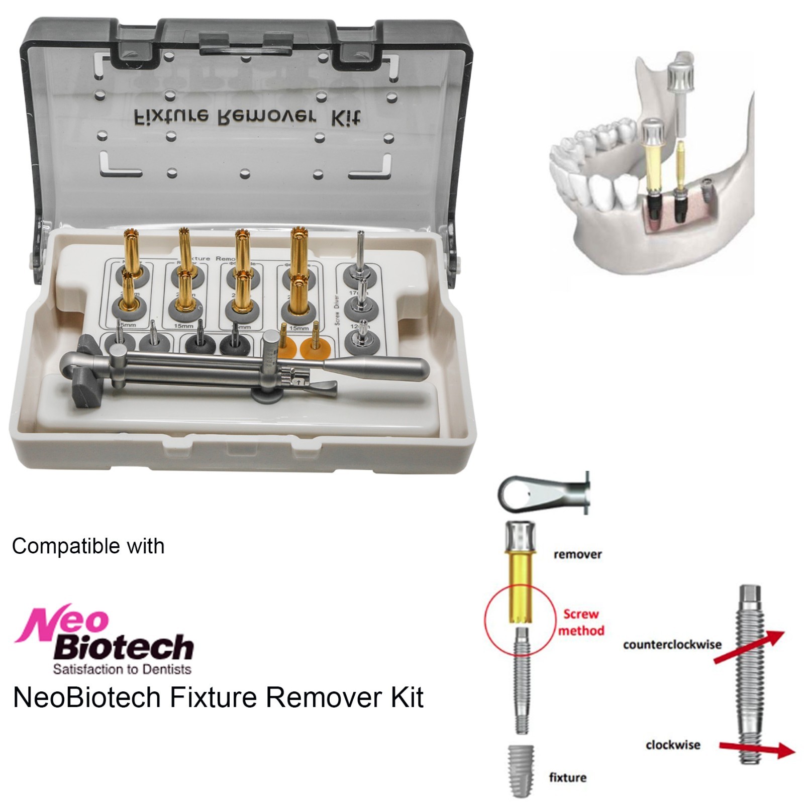 NeoBiotech FR Implant Fixture Remover Kit Compatible with Internal Hex Tools New