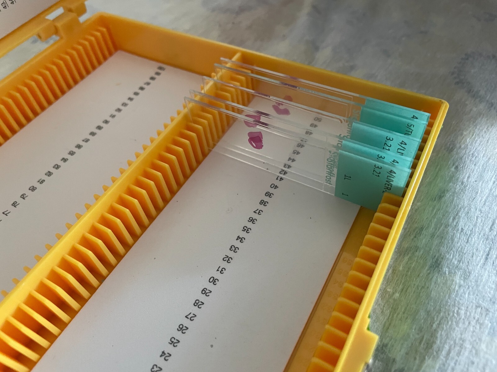 Two Microscope storage boxes with mouse tissues slides