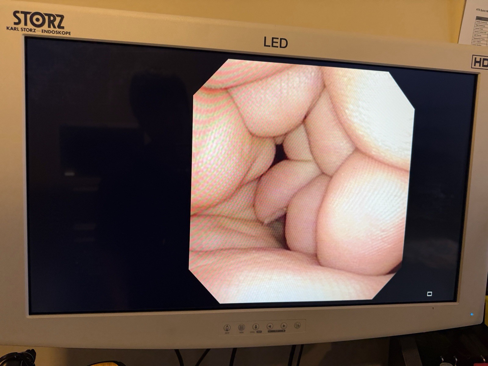 Olympus CYF-V2R Cysto-Nephro Videoscope Endoscope