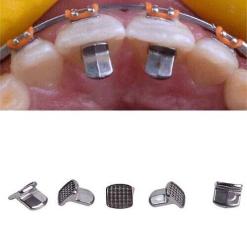 100Pcs Dental Orthodontic MIM Bite Turbos Tongue Tamers Monoblock Bondable Hinge