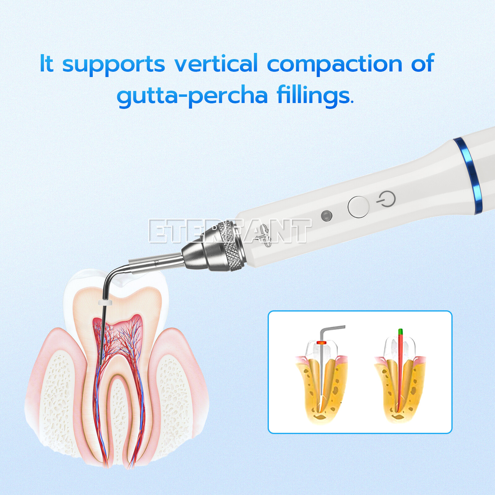 ETERFANT Dental Gutta Percha Obturation System Endo Heated Pen+2xTips white