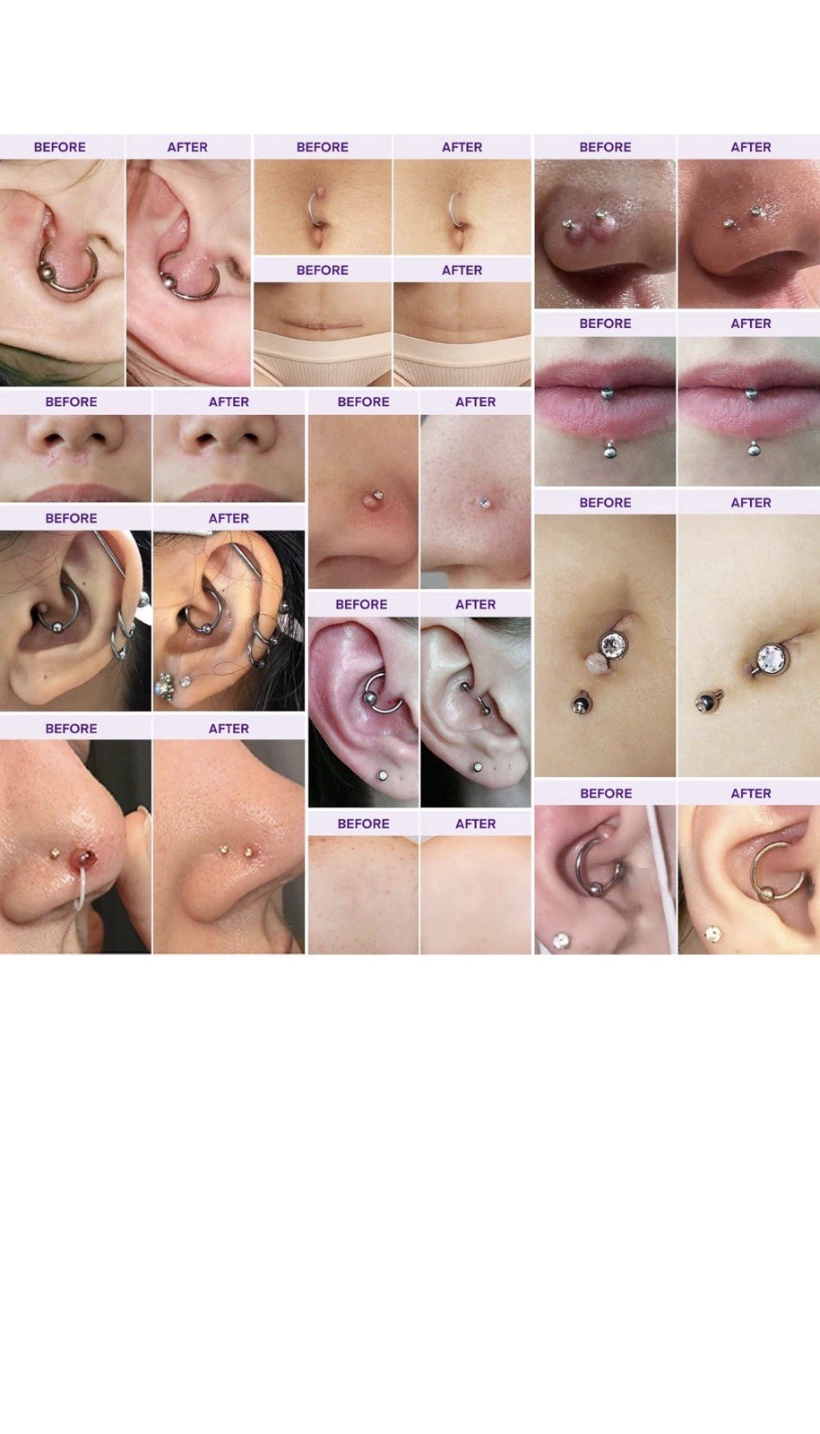Piercing Bump Solution Oil | for Piercing Aftercare & Scar Appearance
