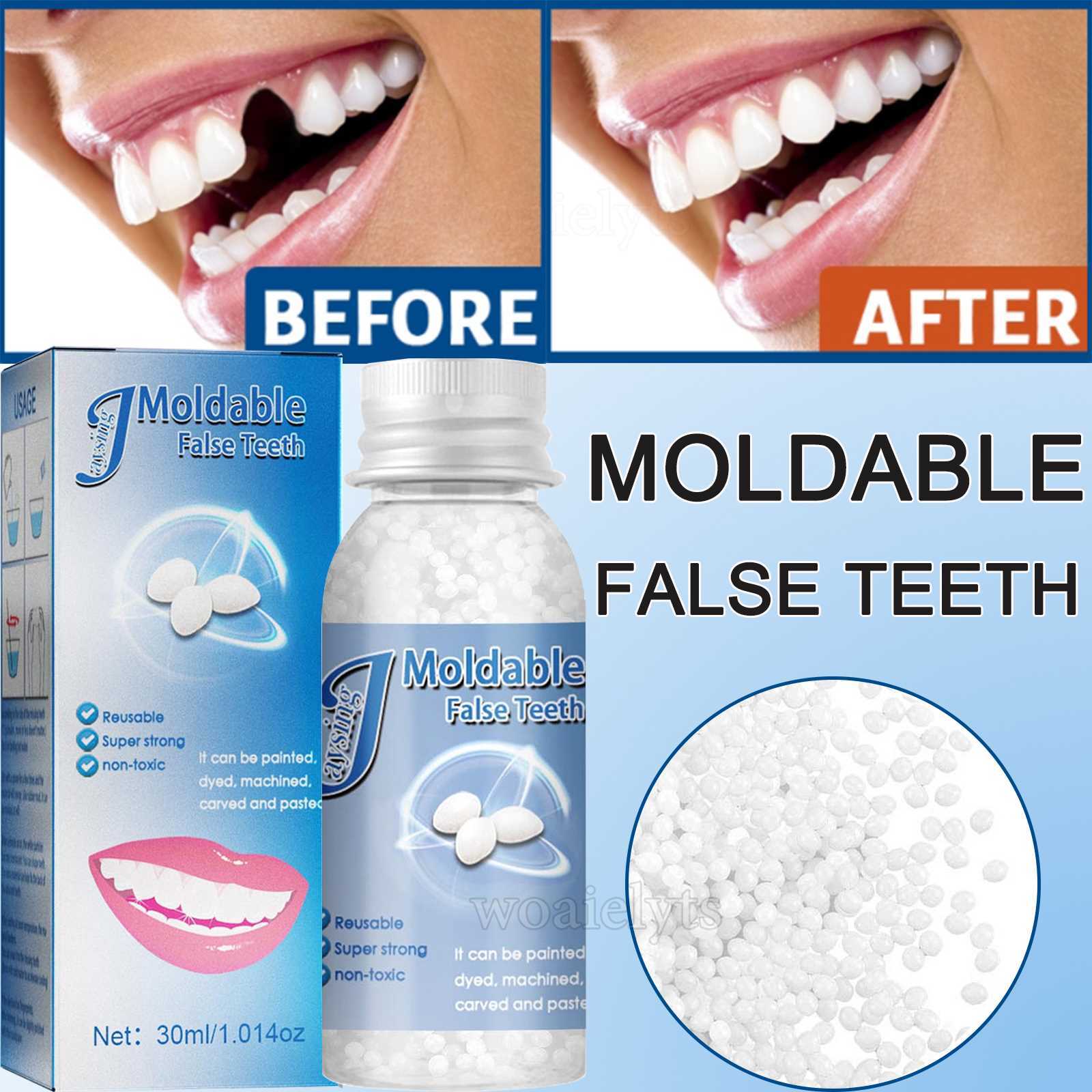 UK Tooth Repair Kit Temporary Teeth Replacement Beads for Missing & Broken Teeth