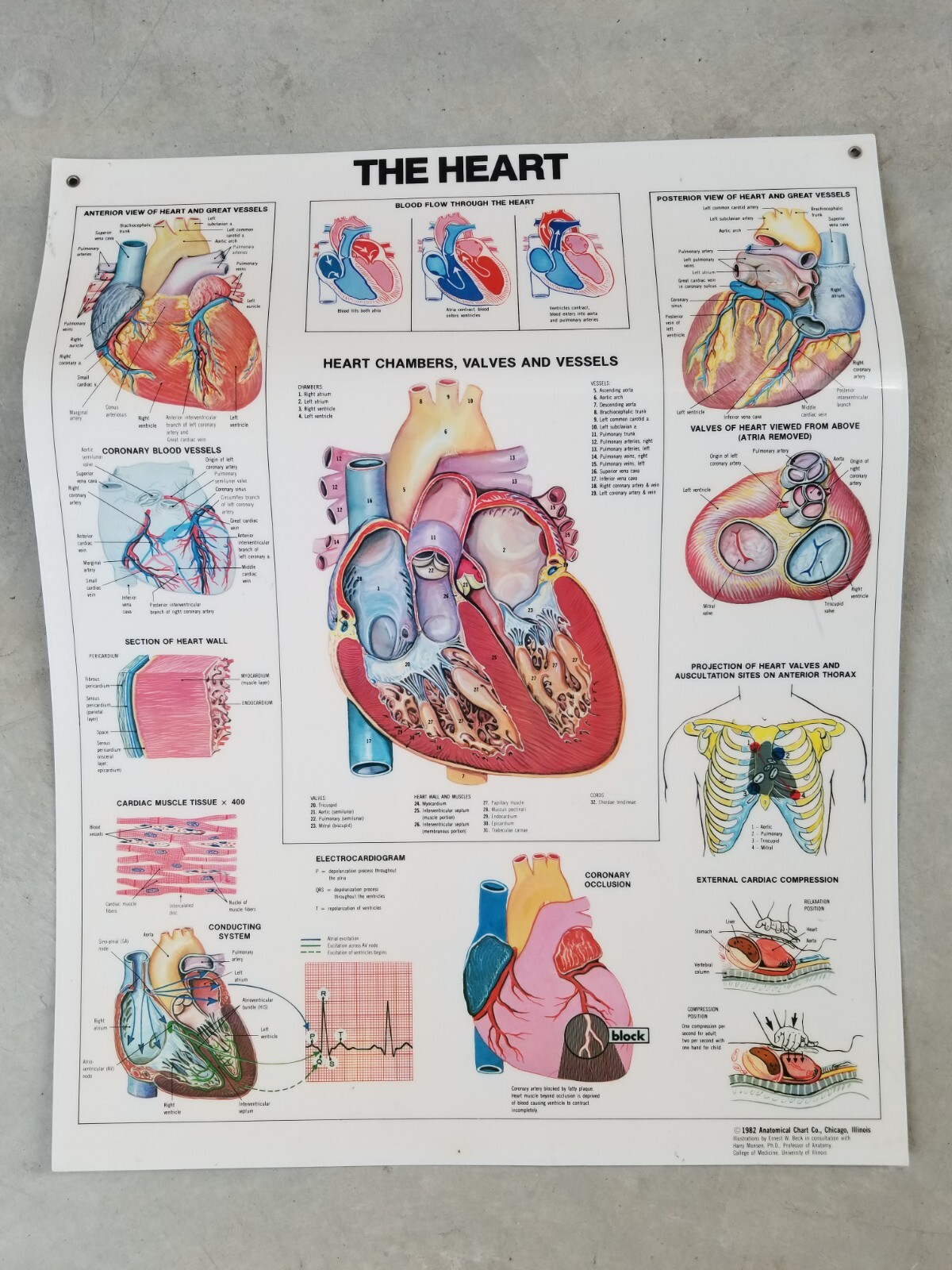Heart Anatomical Chart - 1982 Anatomical Chart Co., Chicago, IL