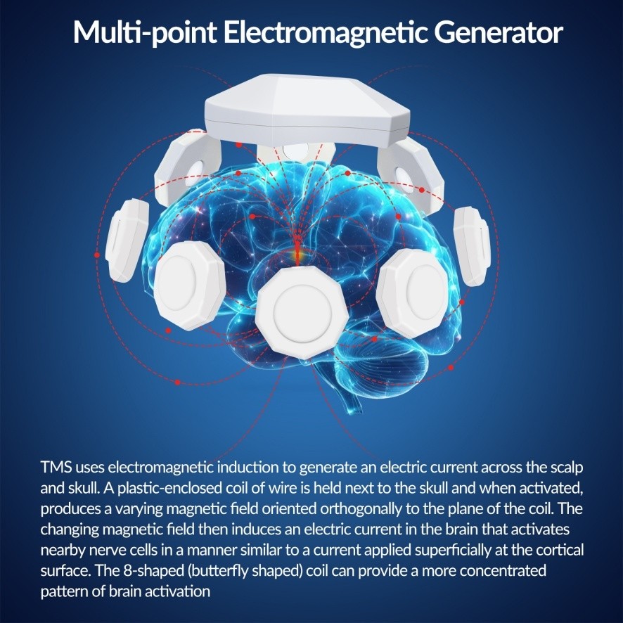 rTMS Therapy Device for Memory Improvement & Sleep Aid