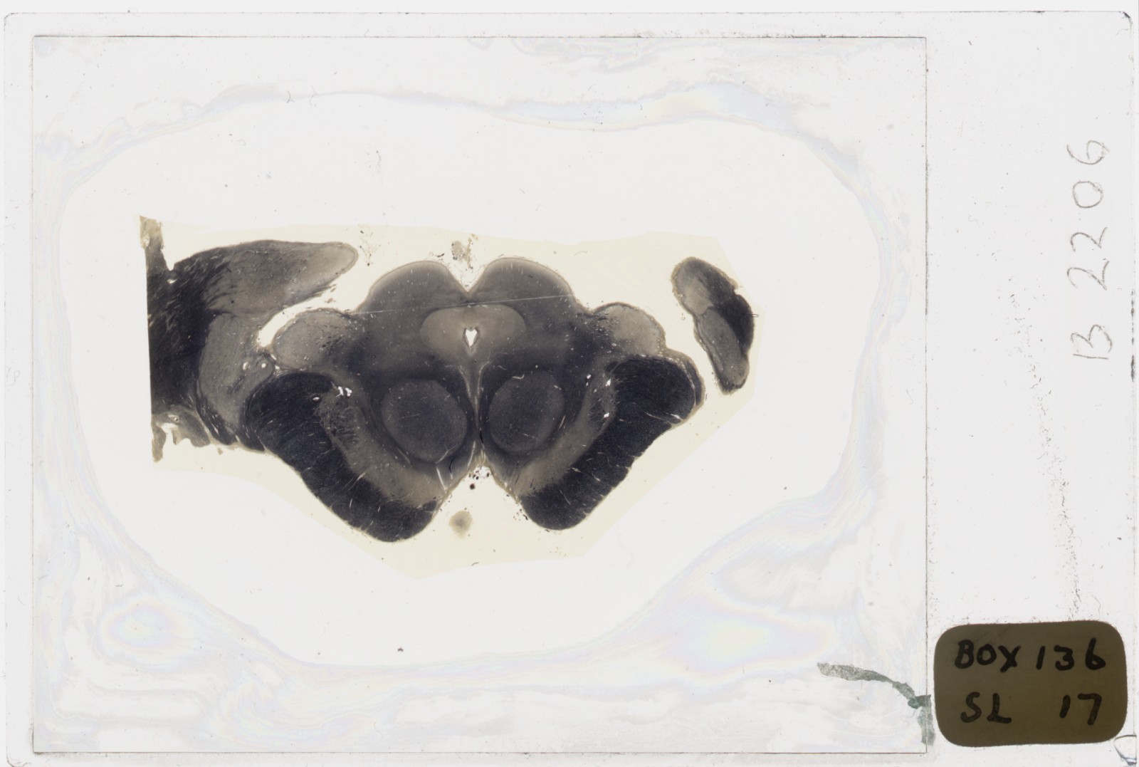 Human Brain Stem Oversized Microscope Slide - Free worldwide shipping!