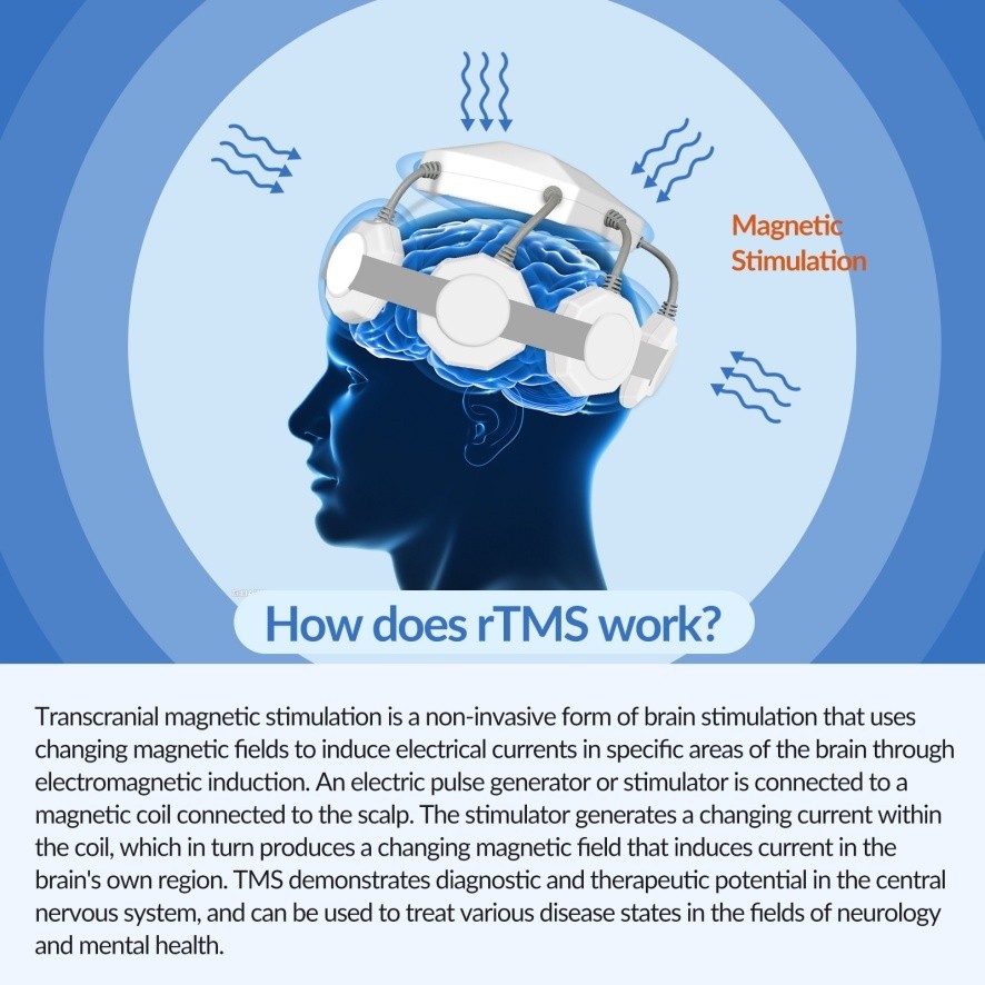 rTMS Transcranial Magnetic Stimulation Machine For Brain Mental Illness