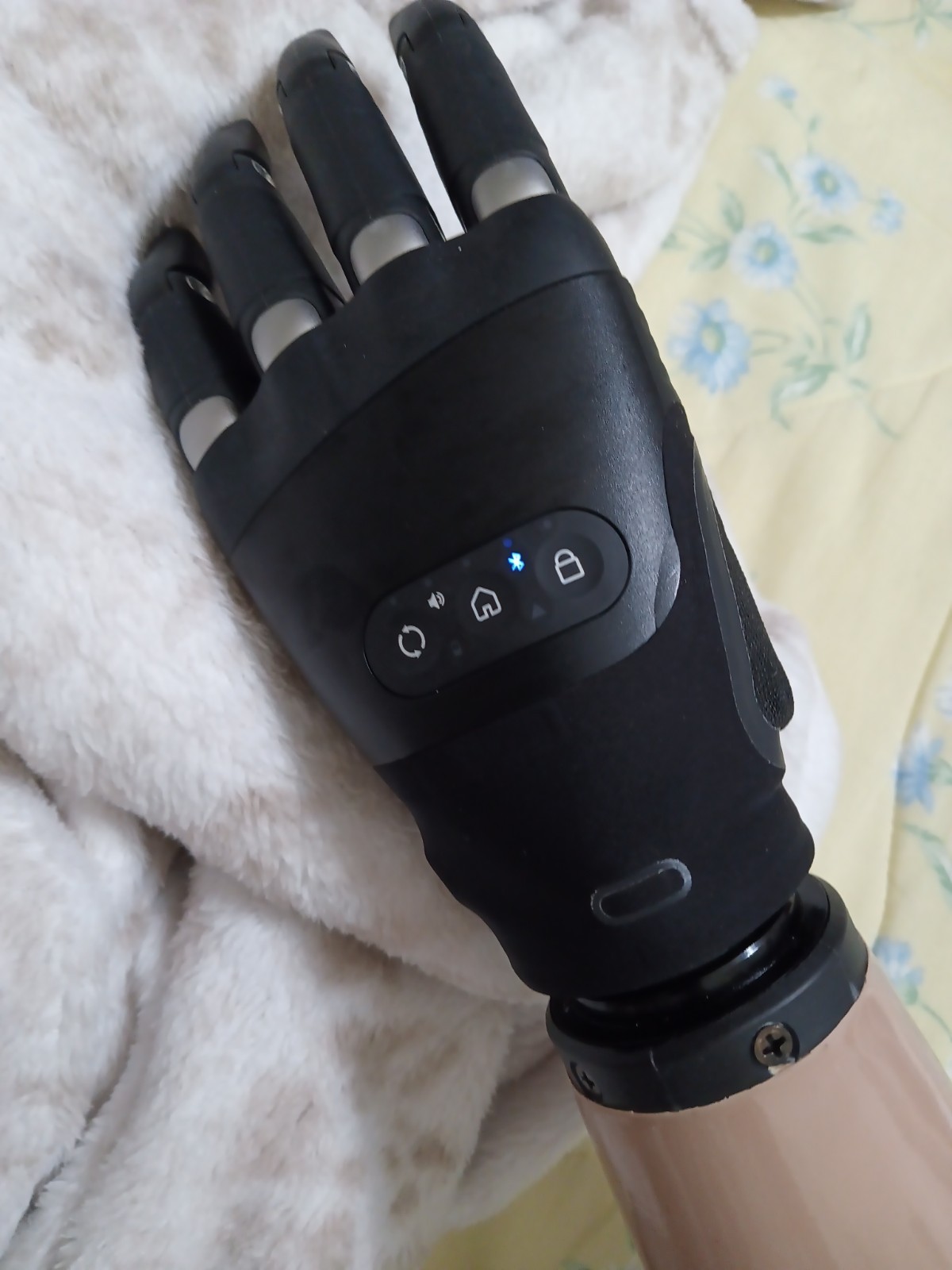 Touch Bionics i-Limb System Ottobock Myoelectric Prosthetic Hand Left