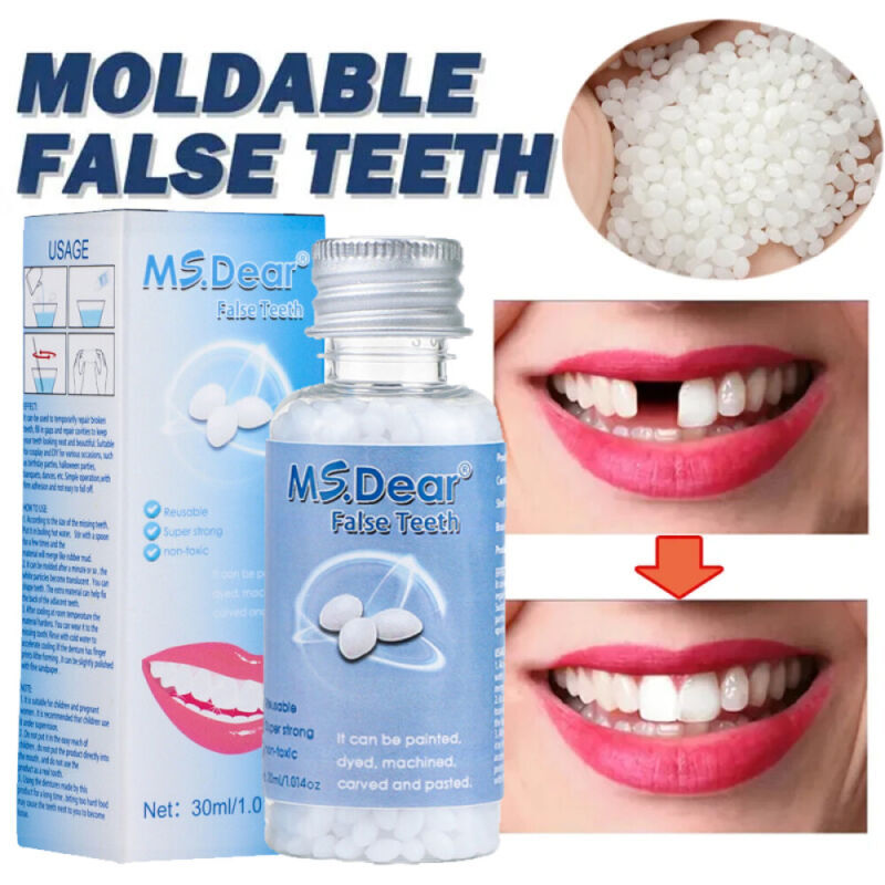 Tooth Repair Kit - Temporary Teeth Replacement Kit for Missing & Broken Teeth