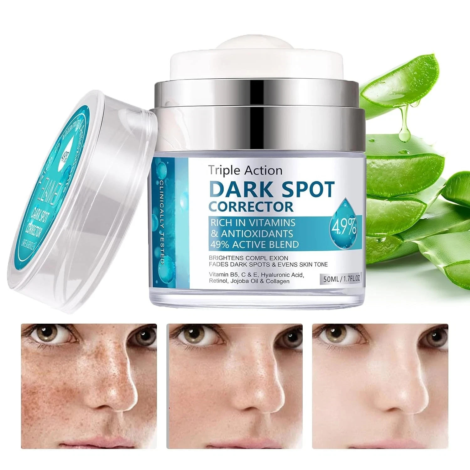 Crema para Manchas Oscuras en La Cara, Cremas Quitar de La...