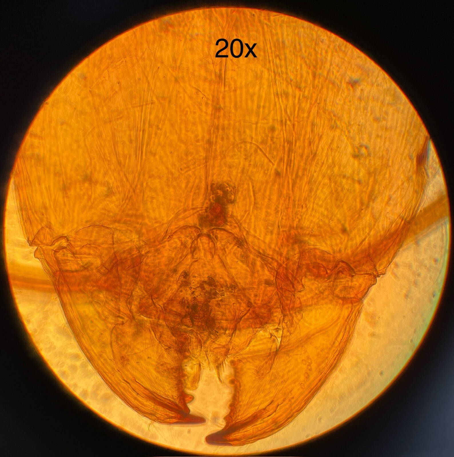 Olympus Tokyo CK Inverted Binocular Microscope W/ illuminator, objectives