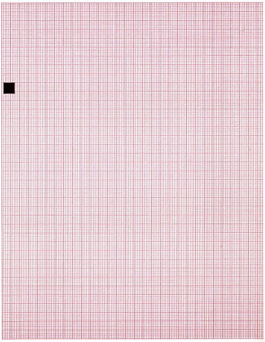 ECG Paper Z-FOLD 209MM X 150MM X 150 SHEETS (Works with CARDIETTE AR2100, PK10