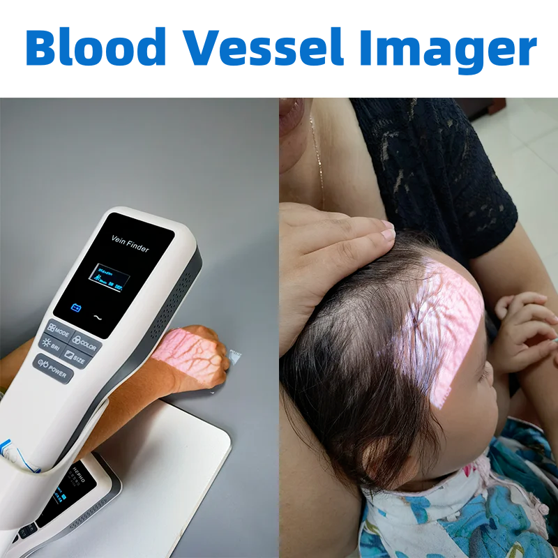 Vein Finder Locator Handheld Portable Near-Infrared Blood Vessel Display Nurse