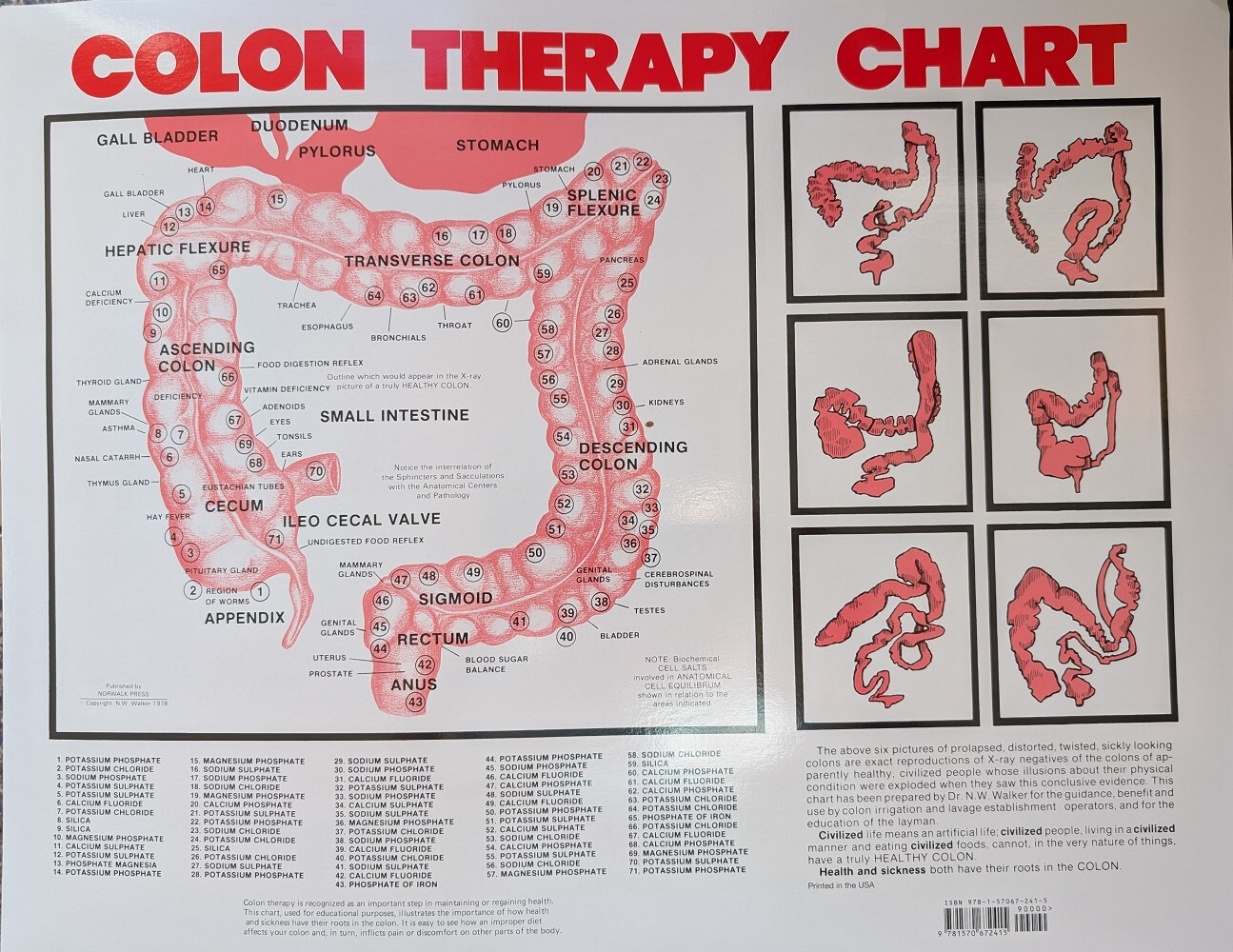 Colon Therapy Chart Map